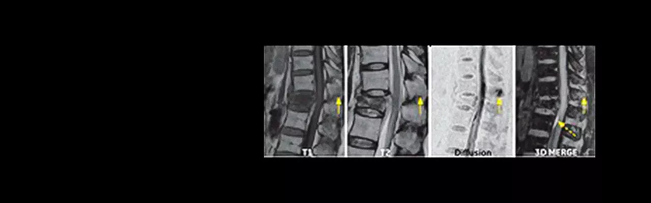 Musculoskeletal