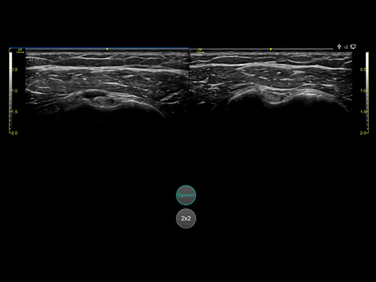 musculoskeletal-follow-up-ci-en