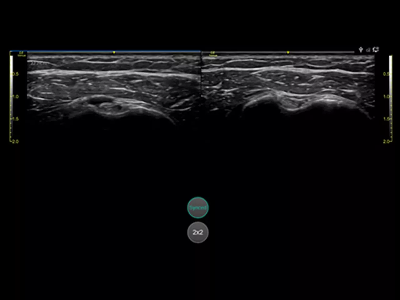 musculoskeletal-follow-up-ci-en