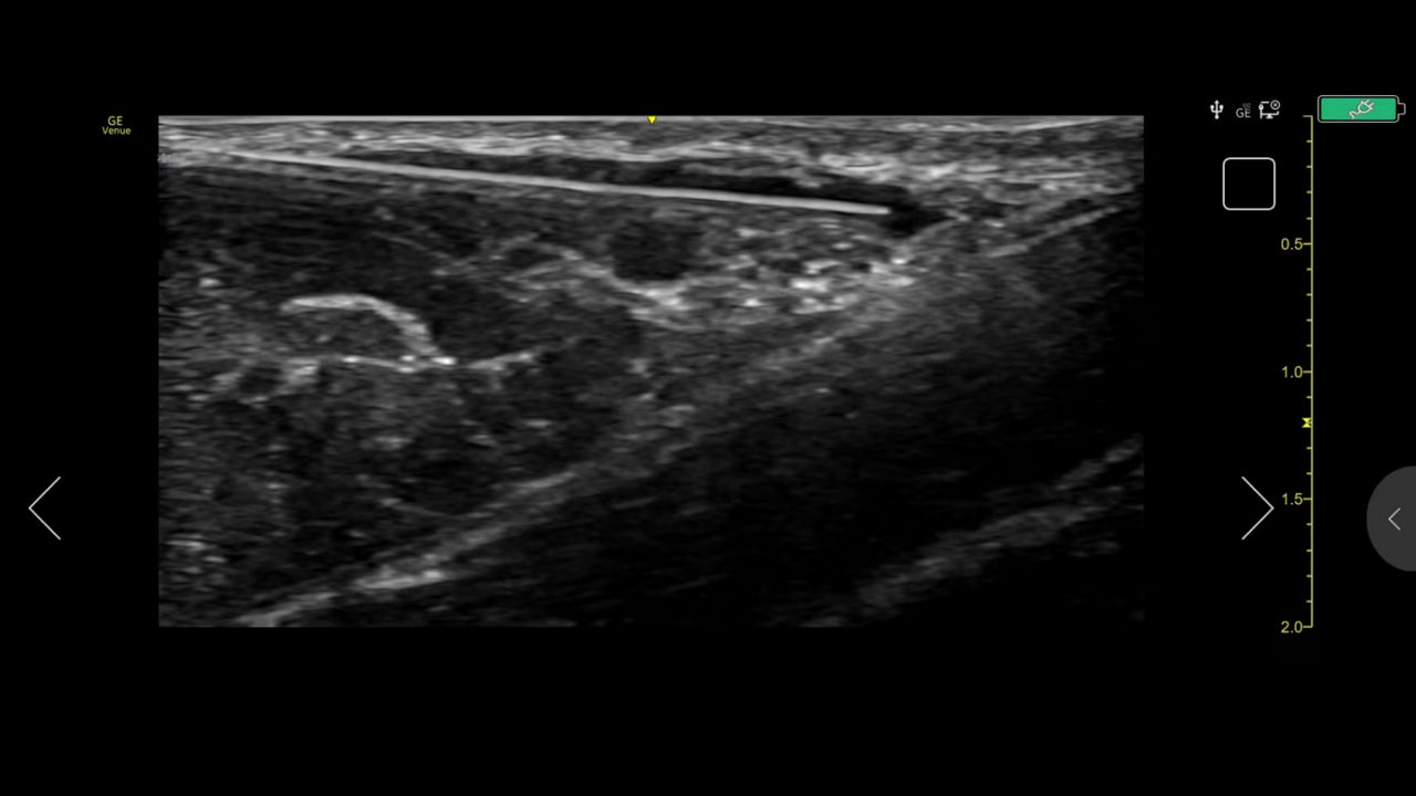 musculoskeletal-simple-screen-ci-en