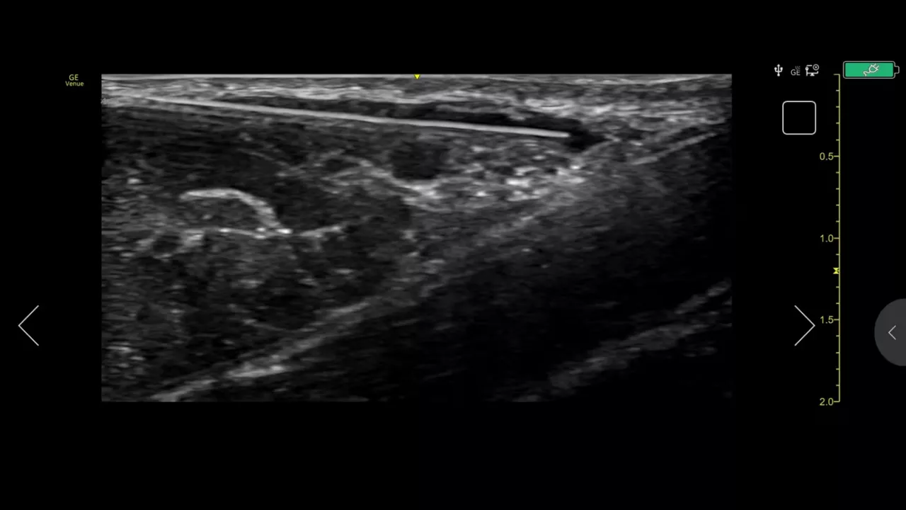 musculoskeletal-simple-screen-ci-en