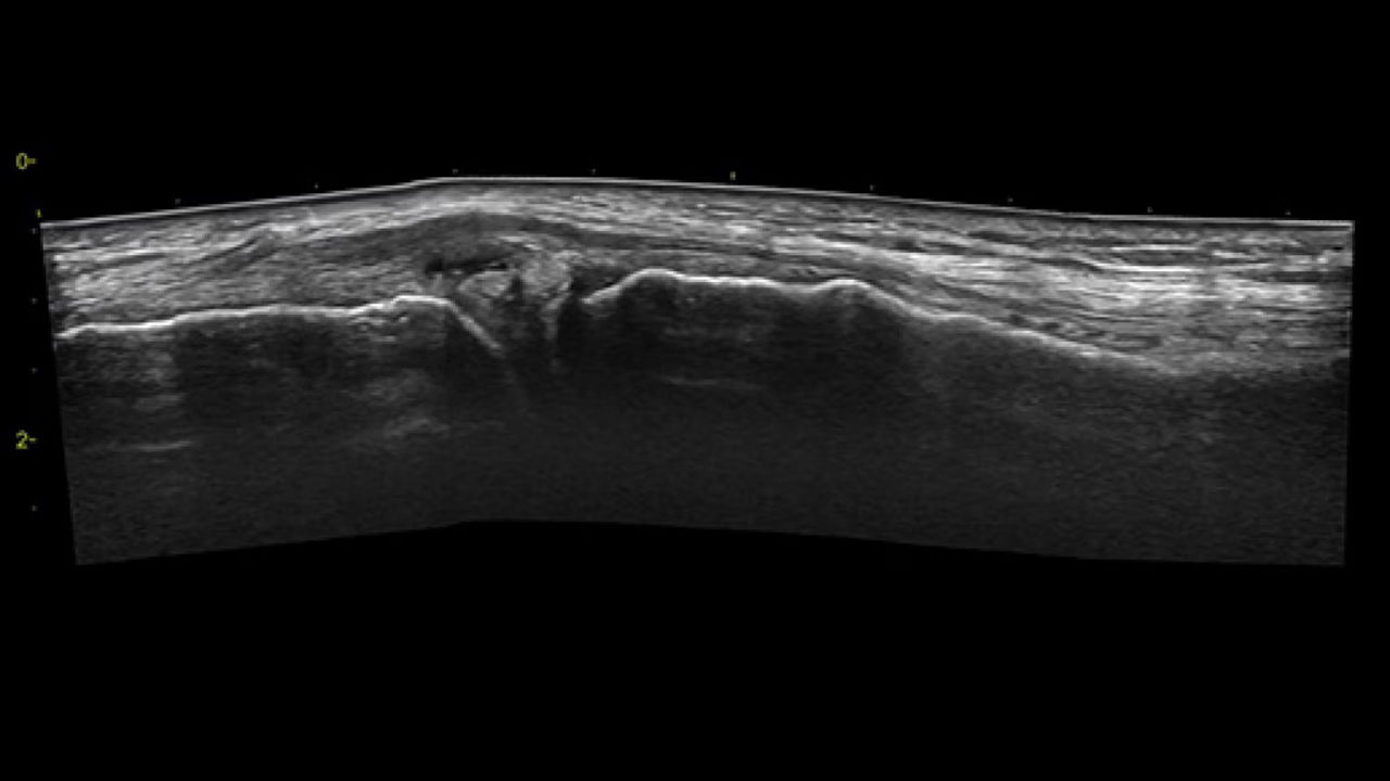 musculoskeletal-venue-view-ci-en