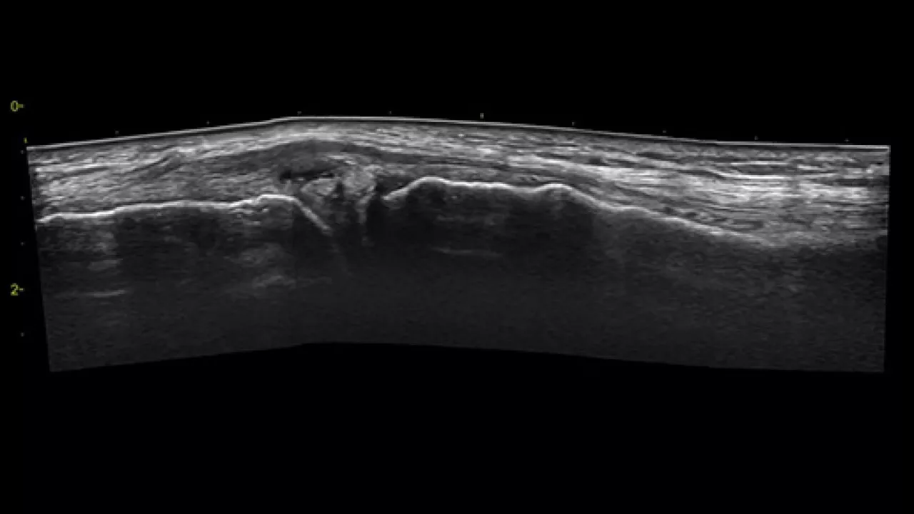 musculoskeletal-venue-view-ci-en