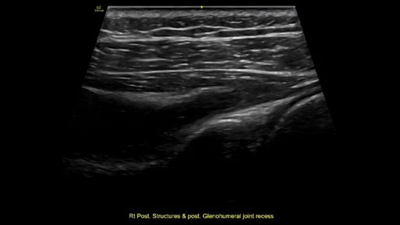 musculoskeletal-virtual-convex-ci-en