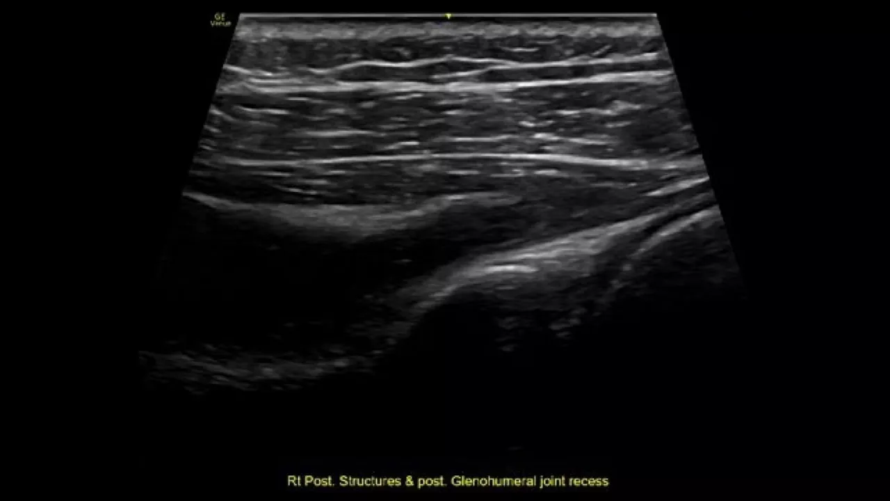 musculoskeletal-virtual-convex-ci-en