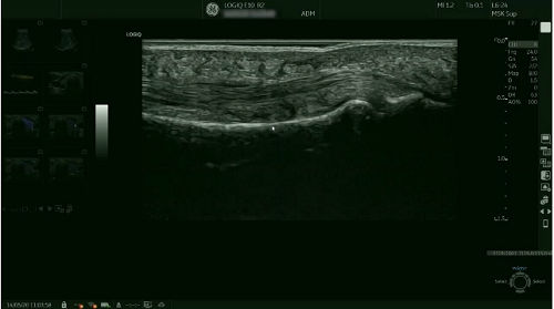 Musculosketal