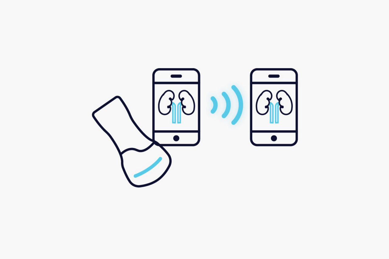 my-remote-share-feature-hero