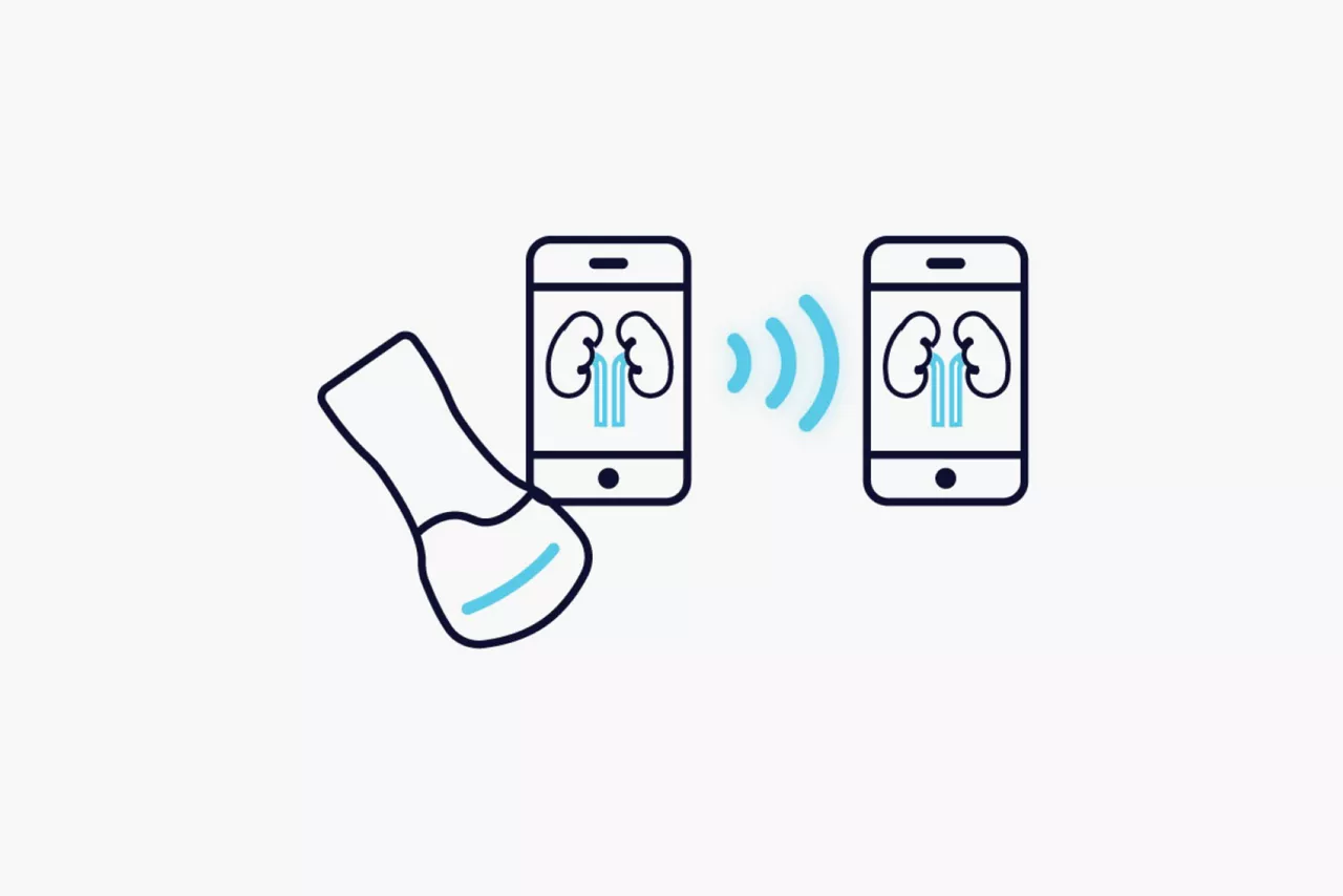 my-remote-share-feature-hero
