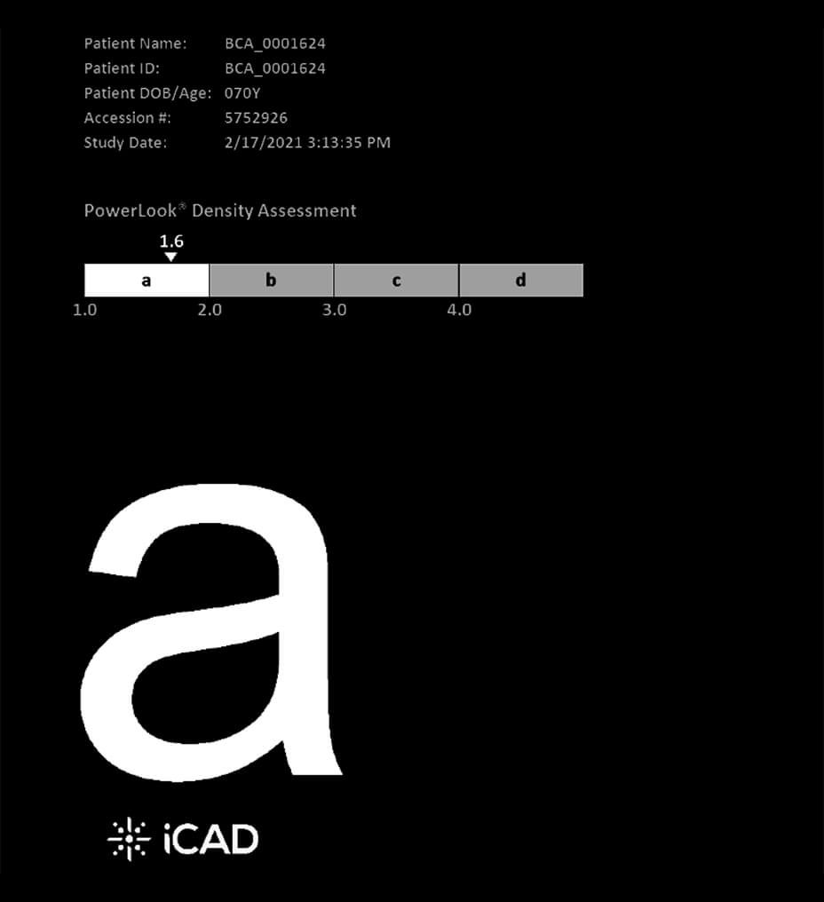 MyBreastAiSuite_feature02