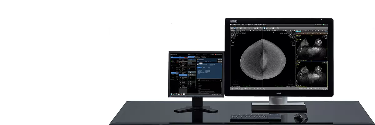 Native Breast Imaging