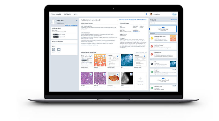 Navify 20 Tumor Board  2