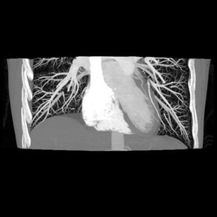 n ct-clinical images-cardiovascular-gehc-revolution-ct-cardiovascular-cinical_coverage.jpg