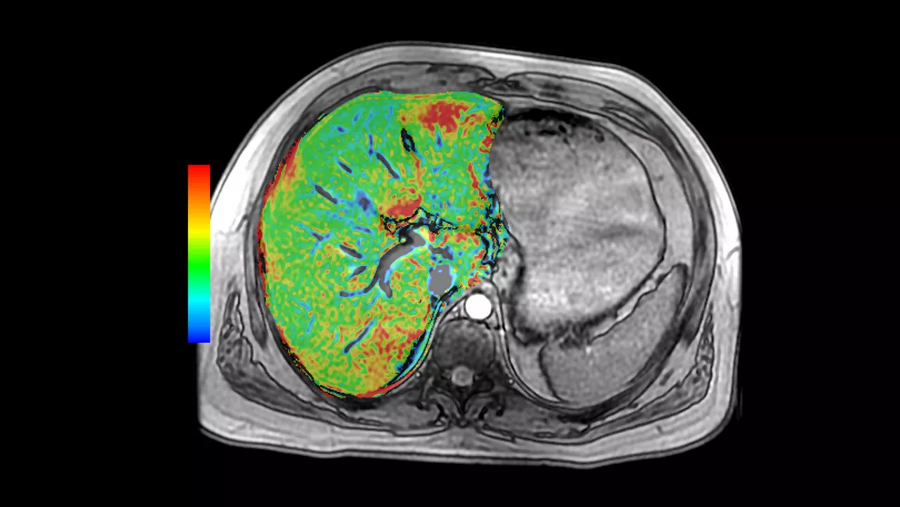 ne-advanced-visualization-applications-readyview-aw-readyview-clinical-image-r2starv1