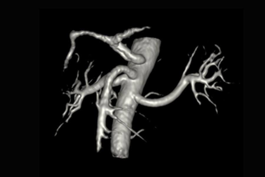 Needle-free imaging