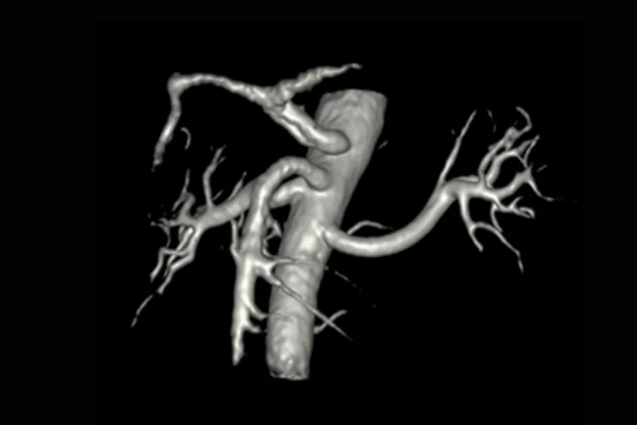 Needle-free imaging