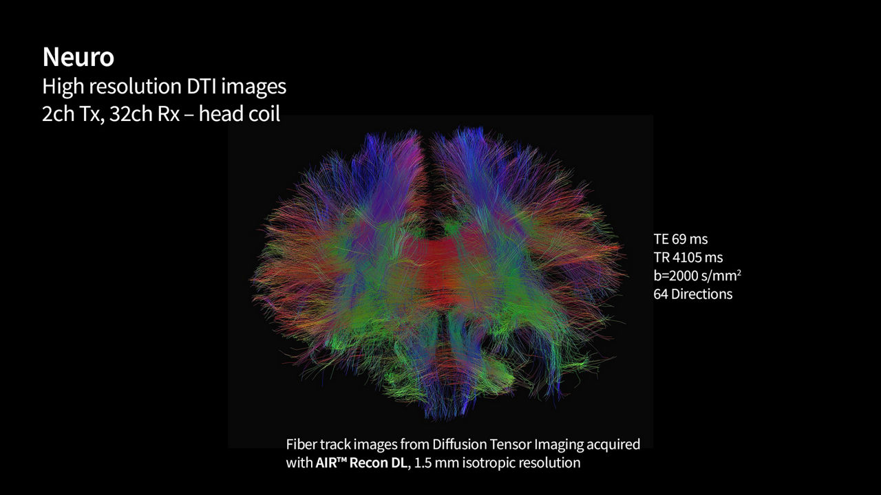 SIGNA 7T MRI scanner clinical images | GE HealthCare (Global English)