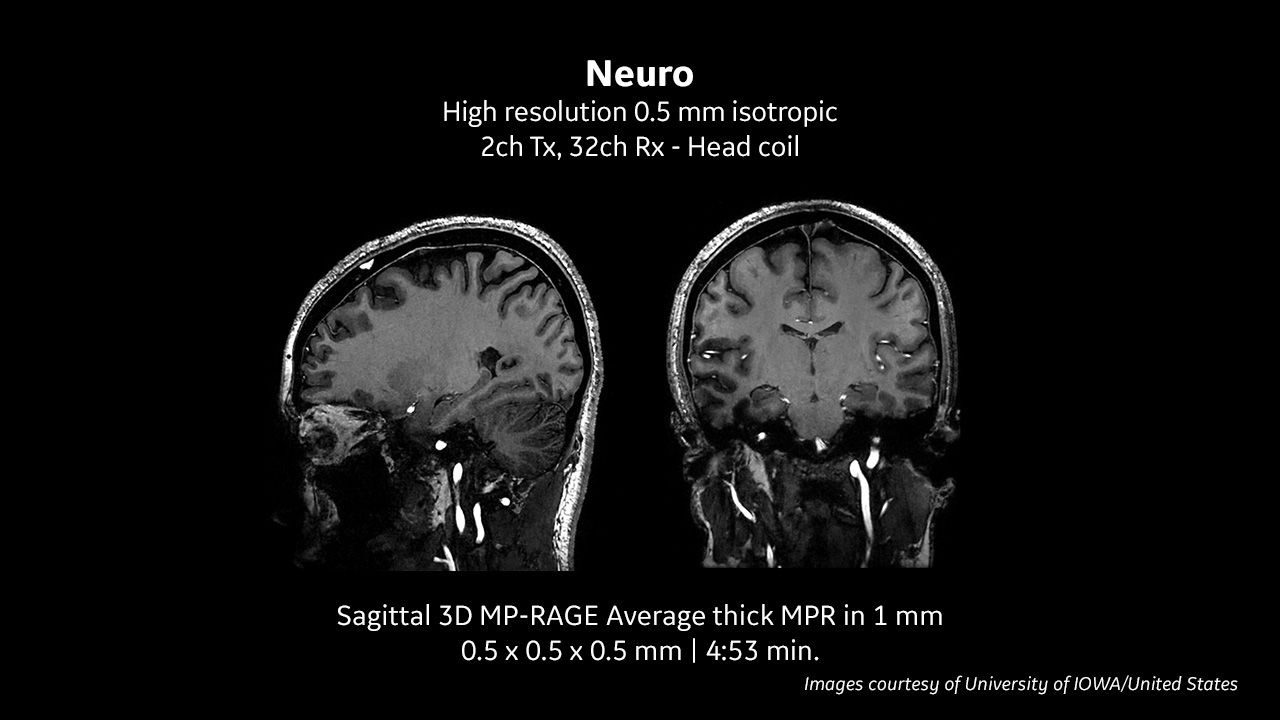 SIGNA™ 7T MRI scanner clinical images | GE HealthCare (Australia
