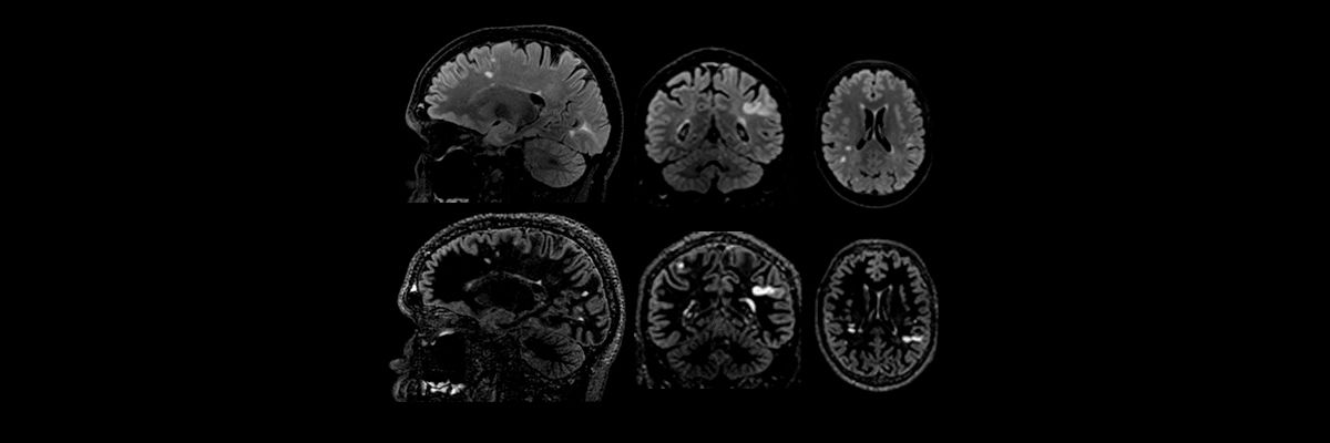 neuro-imaging-cube-2-0-neuro-cube-1200