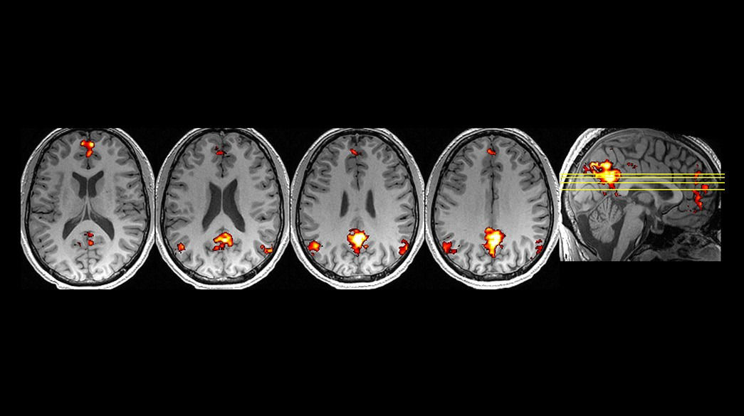 <p>BrainWave</p>
