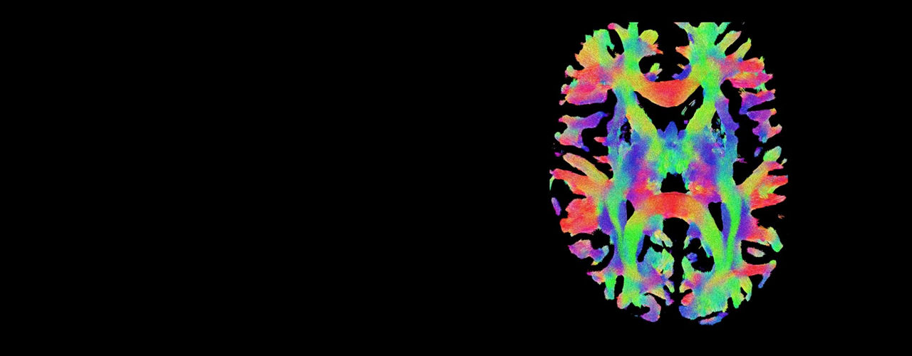 neuro-mri-for-signa-hero-ci-en