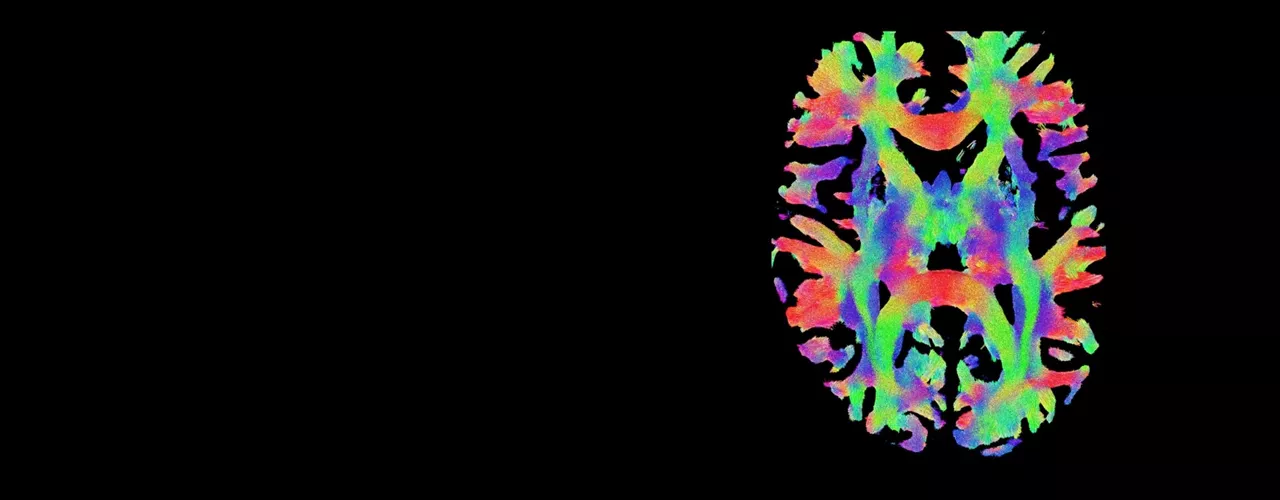 neuro-mri-for-signa-hero-ci-en