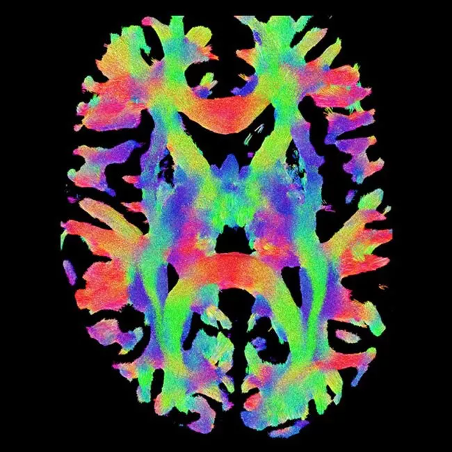 neuro-mri-for-signa-product-tile-ci-en