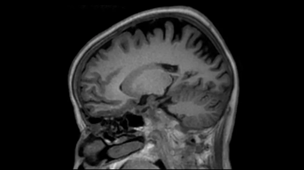 <p>SilentScan</p>
