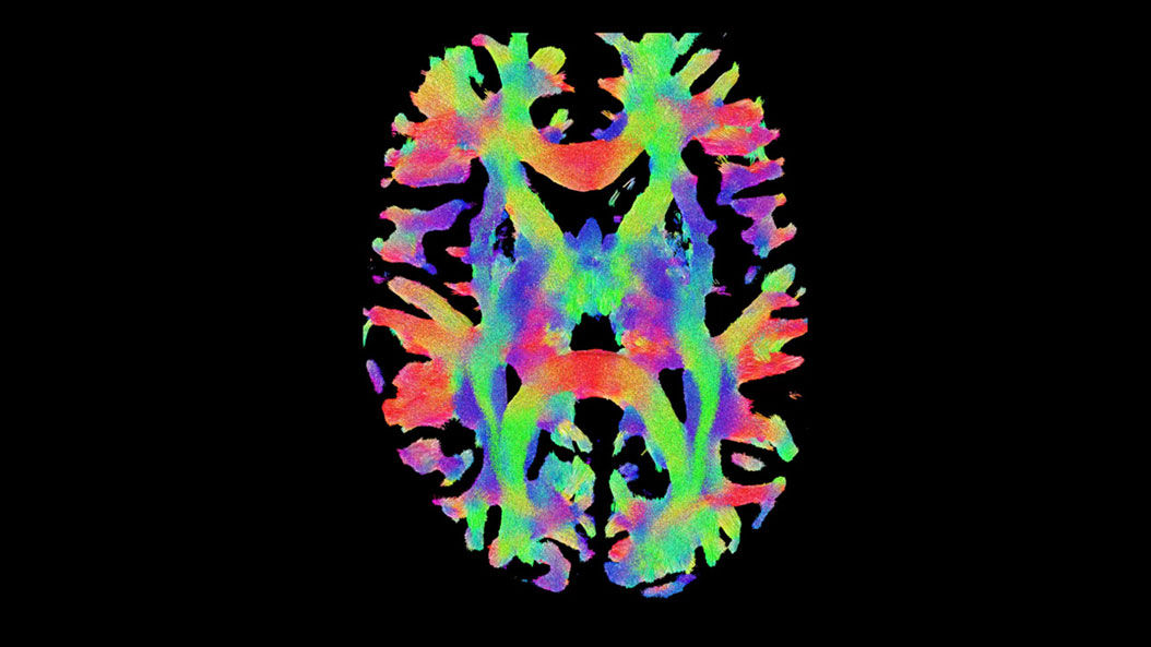 Neuro-MRI-product-switcher-desktop