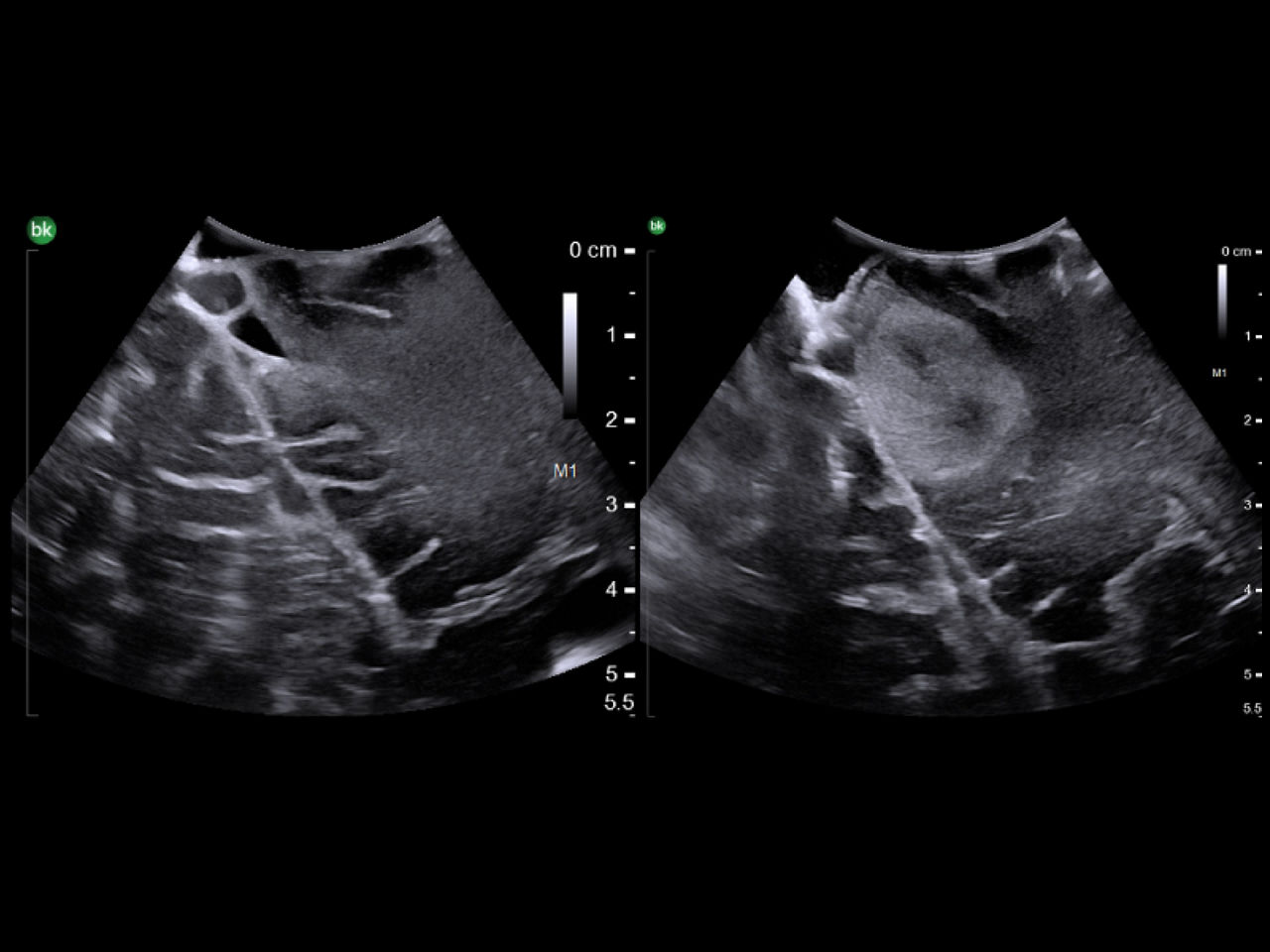 Neuro-oncology-desktop