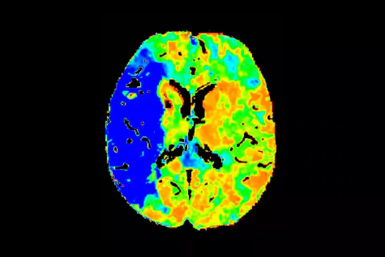 neuro-post-scan