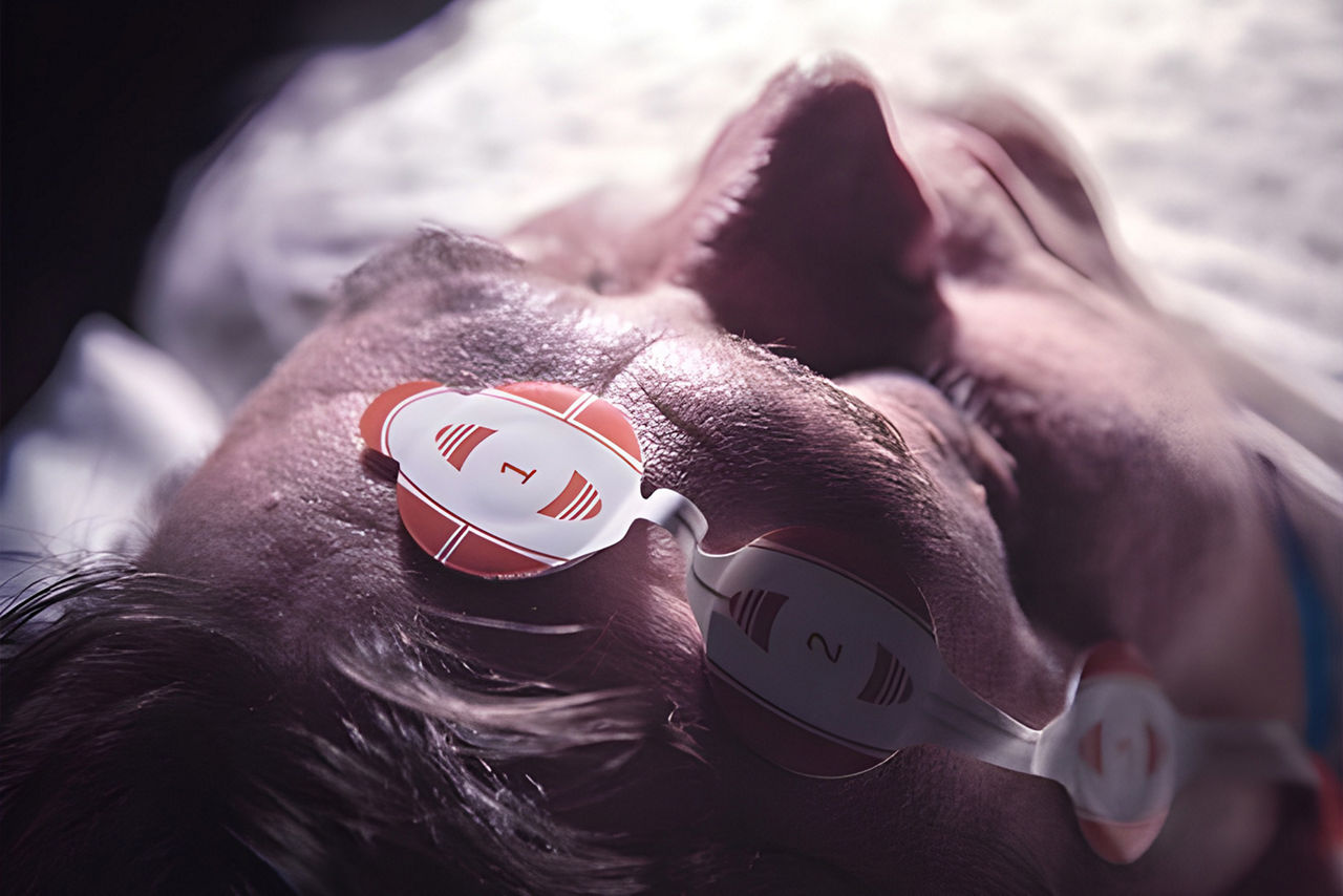 neurological-monitoring-HeroSticky1-ci-en