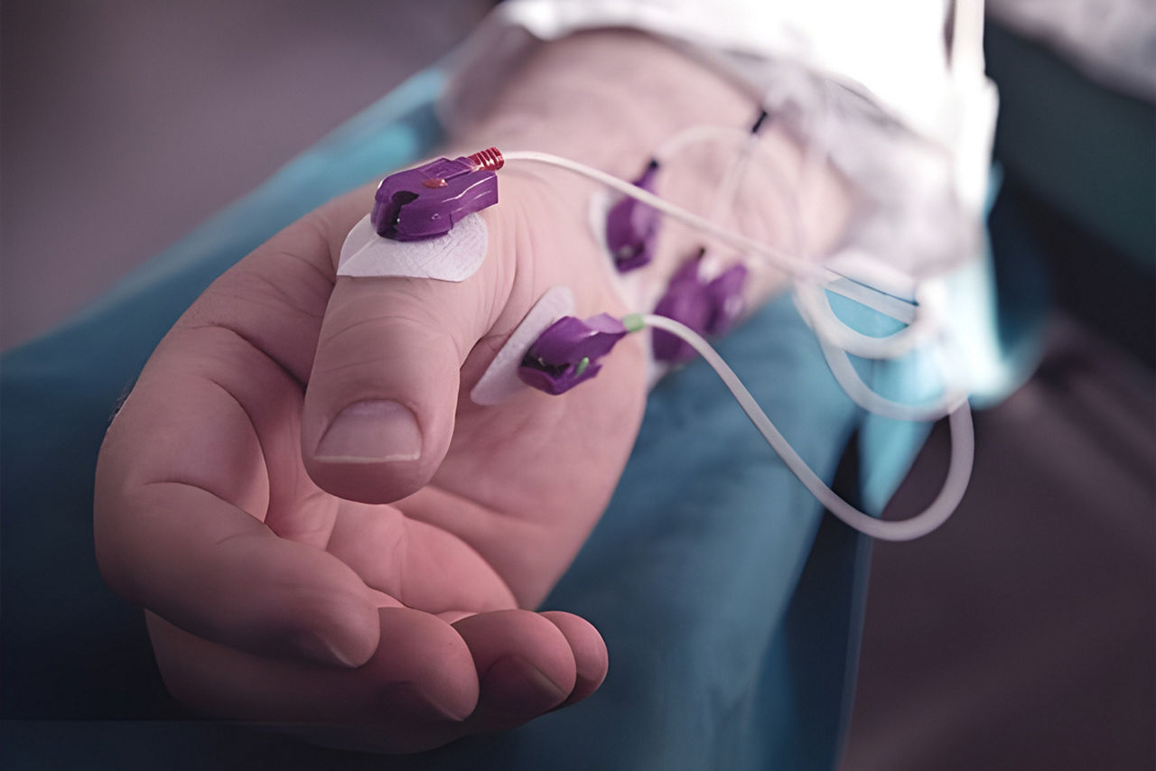 neurological-monitoring-HeroSticky3-ci-en