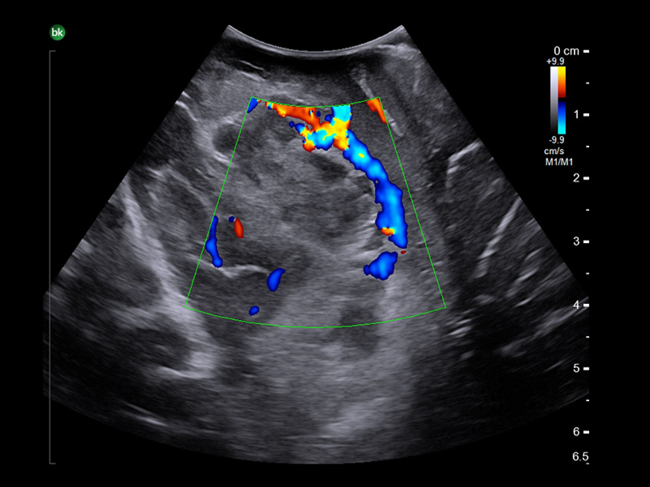 Neurovascular-desktop
