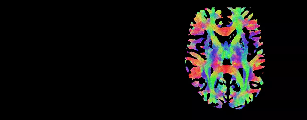 NeuroWorks-hero-desktop