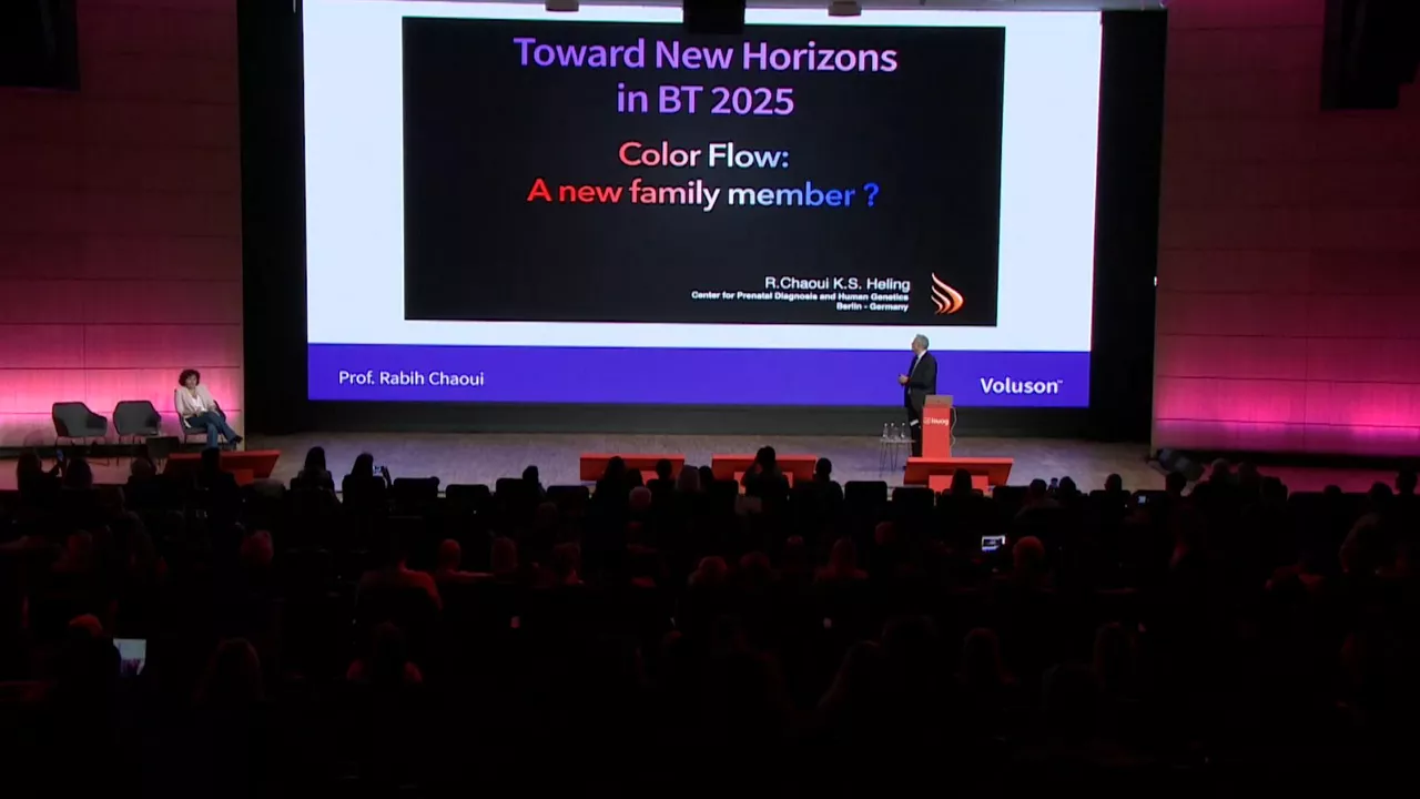 new-horizons-in-fetal-imaging-voluson-graphicflow
