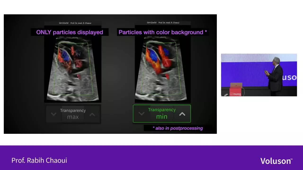 New Horizons in Fetal Imaging Voluson Graphicflow
