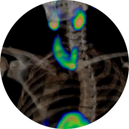 nm-ct-870czt-clinicalimagegallery-genericmodule