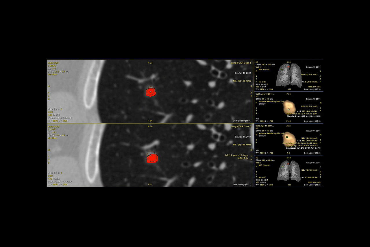 Nodule analysis_desktop