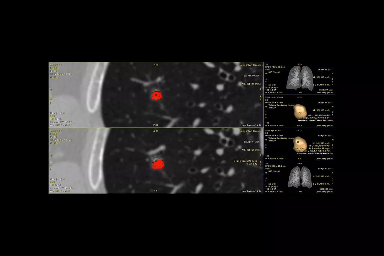 Nodule analysis_desktop