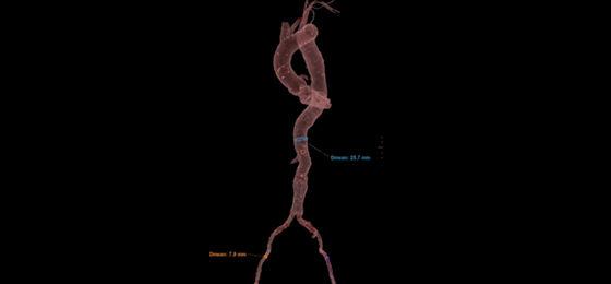 Non Gated axial 560x260