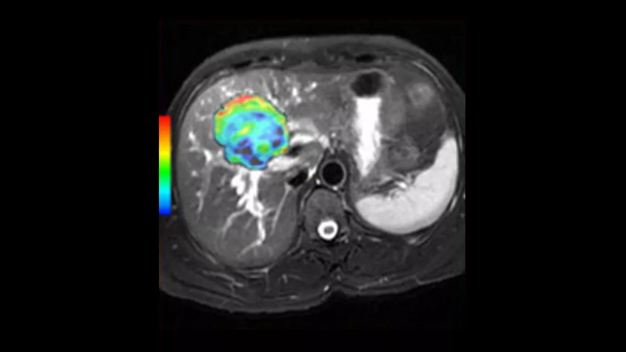 not-clone-advanced-visualization-applications-readyview-aw-readyview-clinical-image-1
