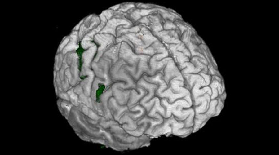 notcloneadvancedvisualizationapplicationsbrainwaveawbrainwaveclinicalimage1