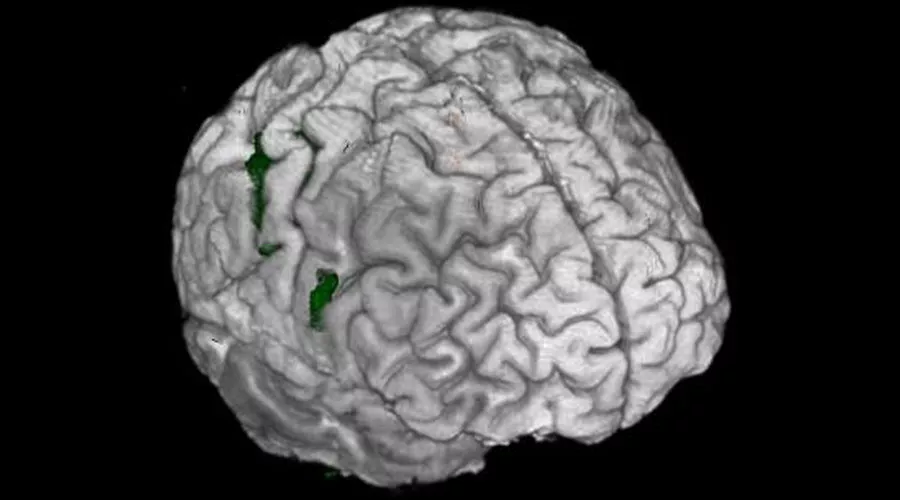 notcloneadvancedvisualizationapplicationsbrainwaveawbrainwaveclinicalimage1
