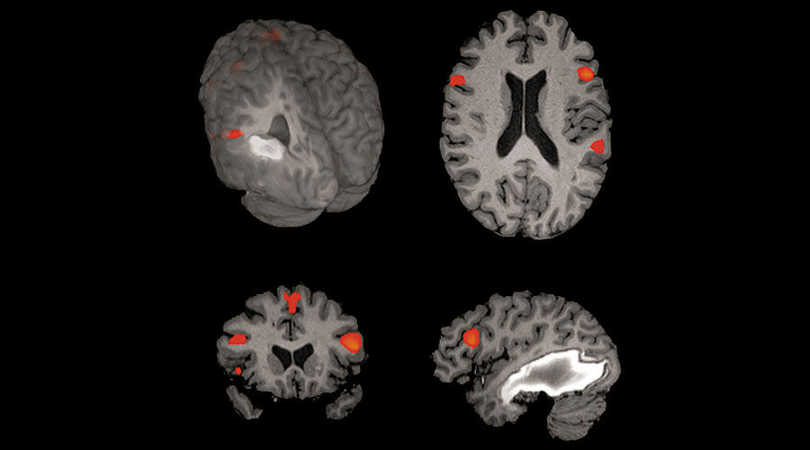 notcloneadvancedvisualizationapplicationsbrainwaveawbrainwaveclinicalimage2