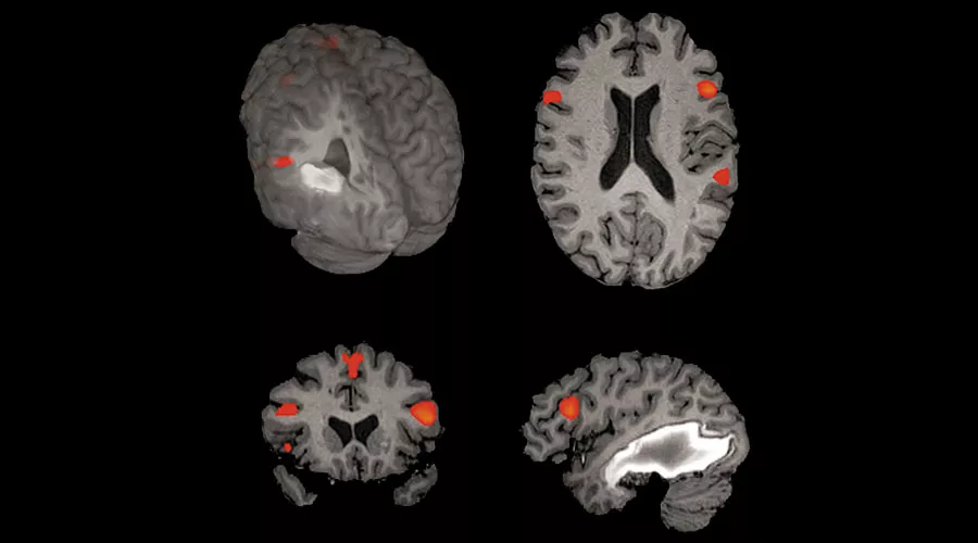 notcloneadvancedvisualizationapplicationsbrainwaveawbrainwaveclinicalimage2