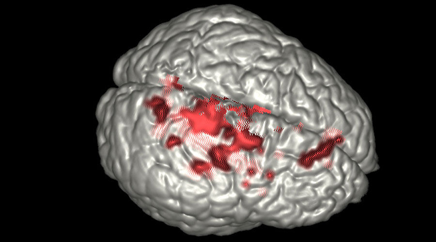 notcloneadvancedvisualizationapplicationsbrainwaveawbrainwaveclinicalimage3