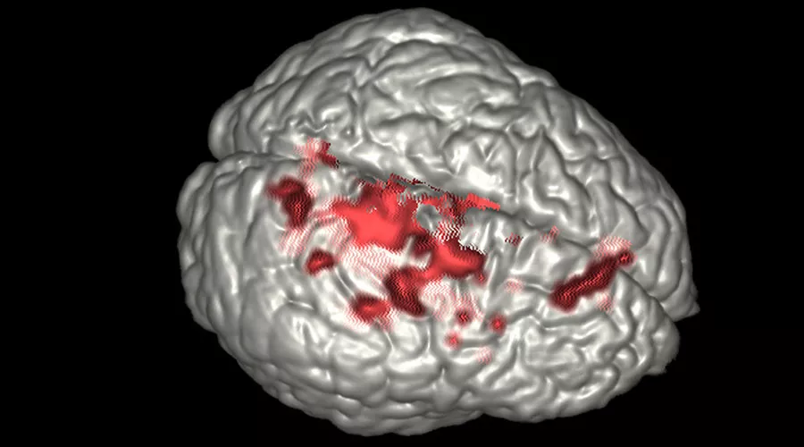 notcloneadvancedvisualizationapplicationsbrainwaveawbrainwaveclinicalimage3