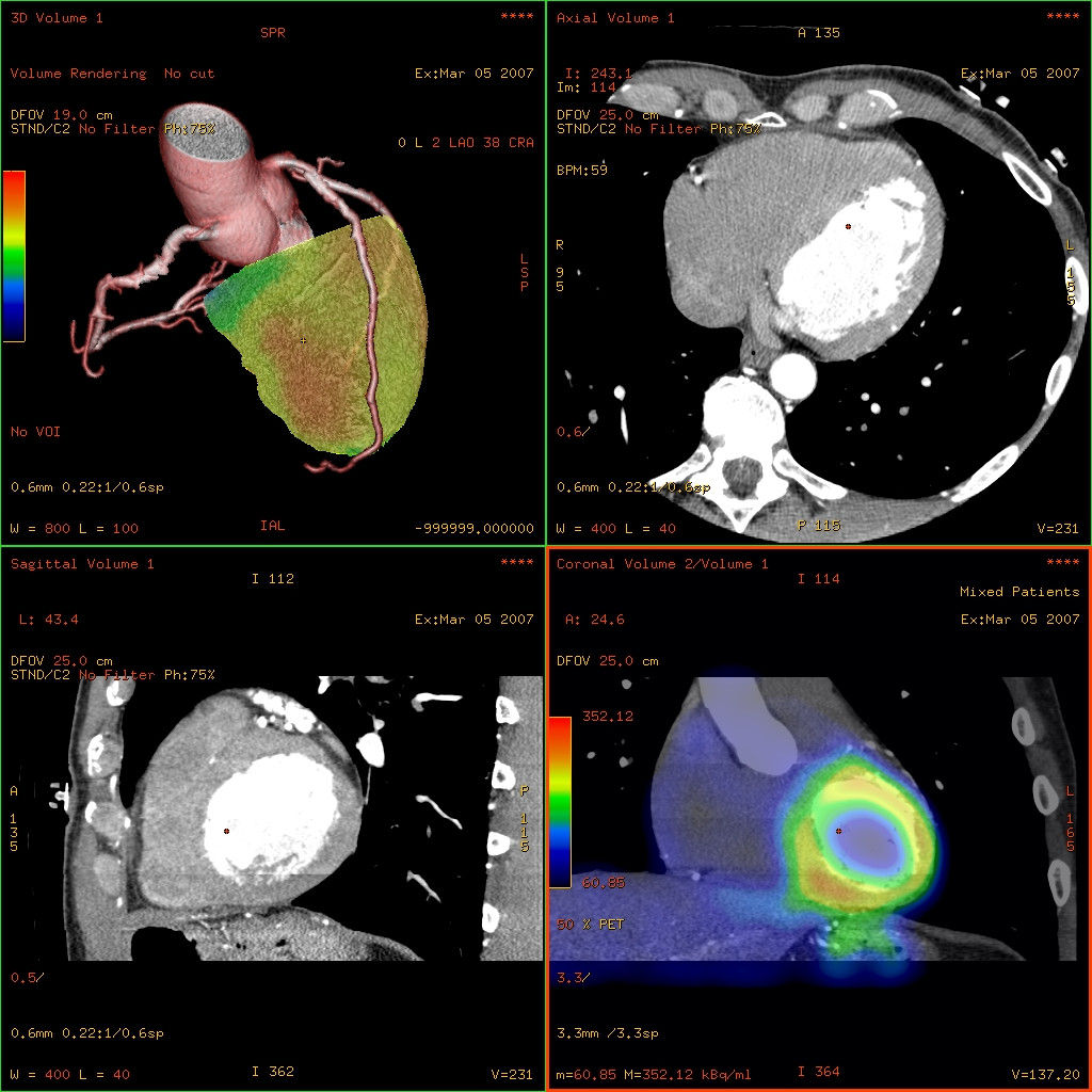 notcloneadvancedvisualizationapplicationscardiq-fusionawcardiqfusionoverviewjpg