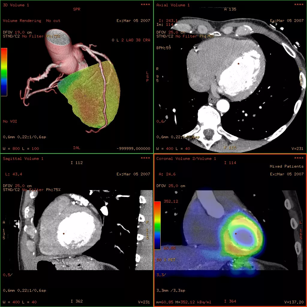 notcloneadvancedvisualizationapplicationscardiq-fusionawcardiqfusionoverviewjpg