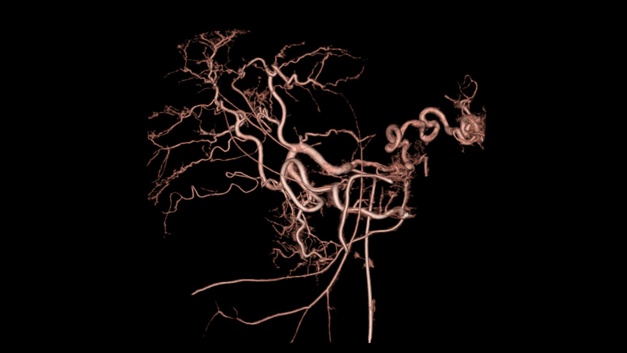 notcloneadvancedvisualizationapplicationsinnova3dawinnova3dclinicalimage4
